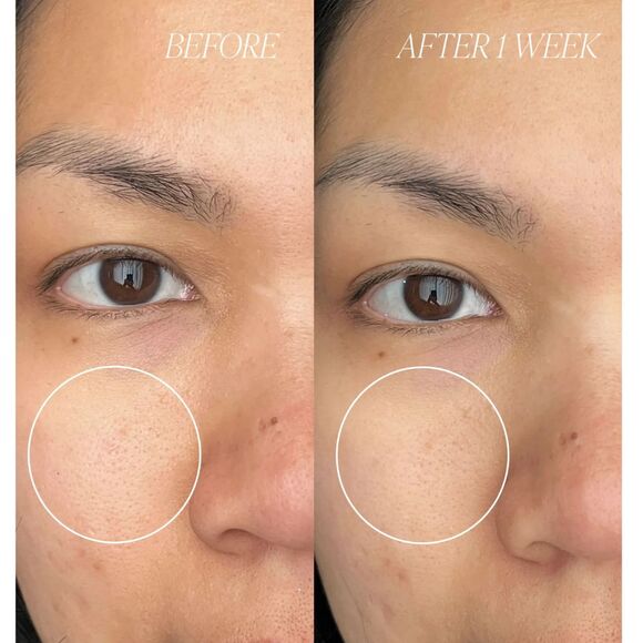 BYROE - Peach Kombucha Tea Purifying Clay Mask - Brand New! - Picture 2 of 6